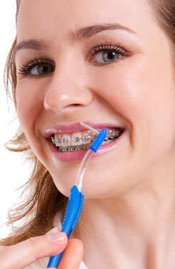 poetsinstructie-orthodontie